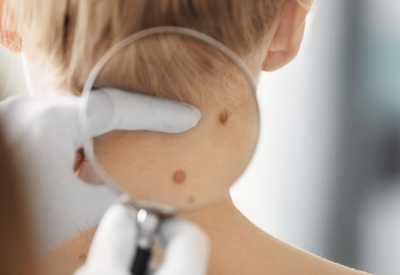 5 Advantages of Seeing a Dermatologist