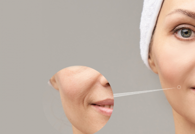 Profhilo, fillers, and Botox: What is the difference?