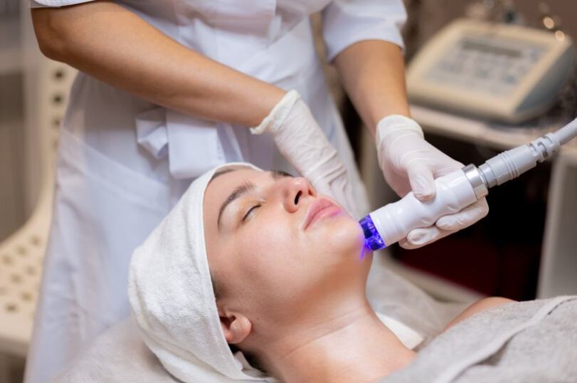 Top 7 Benefits of RF Microneedling: Why You Should Try It